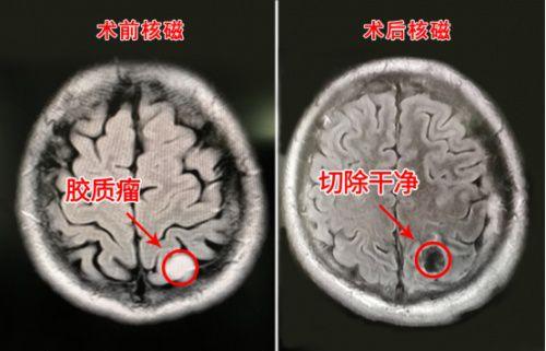 澳门研究生论坛和患瘤拒上夜班被开除与患瘤拒上夜班被开除有赔偿吗